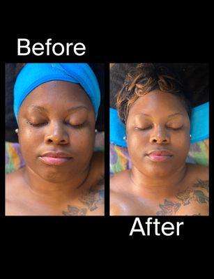 Drainage and hydrating facial