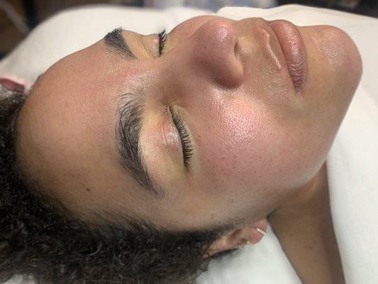 After Pregnancy and breastfeeding a nice facial is necessary!