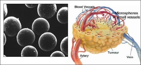 Cancer Treatment and Interventional Oncology