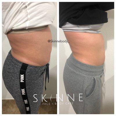 Skinne Face and Body Care