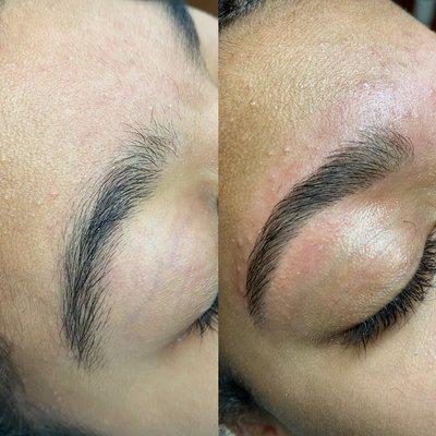 Brow Transformation