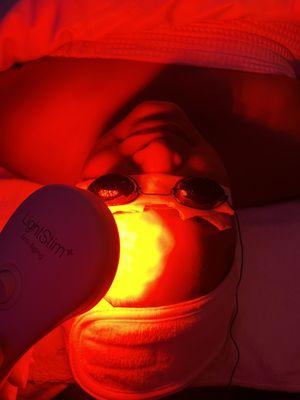 Lightstim treatment