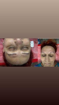 Microblading