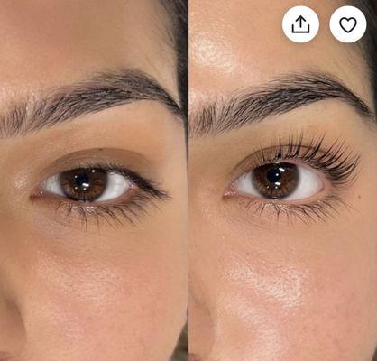 Eye lift