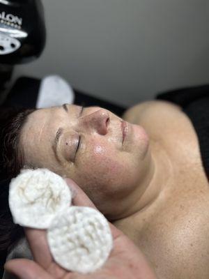 Deluxe facial with a dermaplane add on