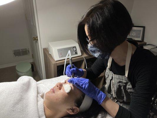 Sue C performing microdermabrasion to improve skin texture.