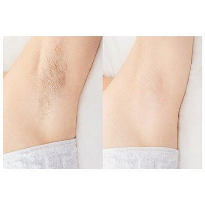 Before and After one Sugaring Session