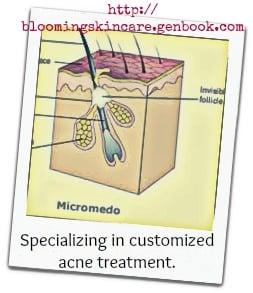 Manage your acne without antibiotics or dangerous prescriptions.