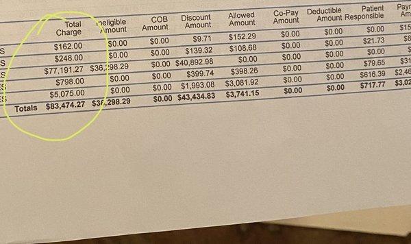 Septoplasty Bill