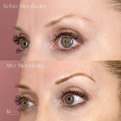 Before and After of Natural Microblading