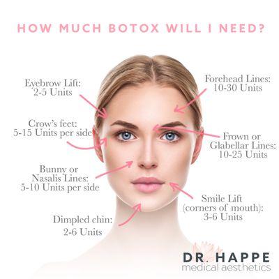 To answer a commonly asked question: how much Botox will I need?