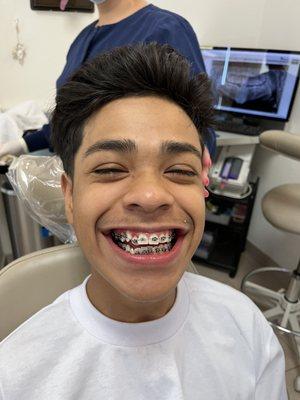 happy he finally has braces!