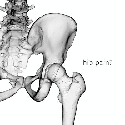 Hip pain? Schedule today!