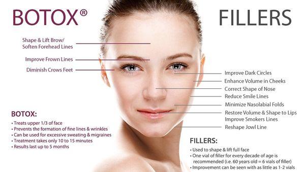 BOTOX/FILLER