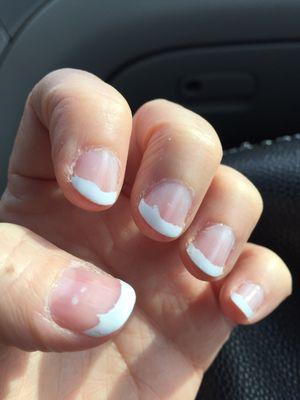 Botched French manicure.