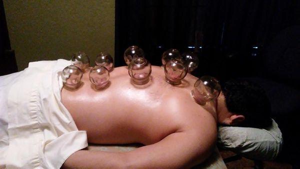 Fire Cupping removes toxins