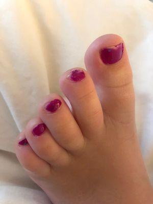 Taken three hours after pedicure