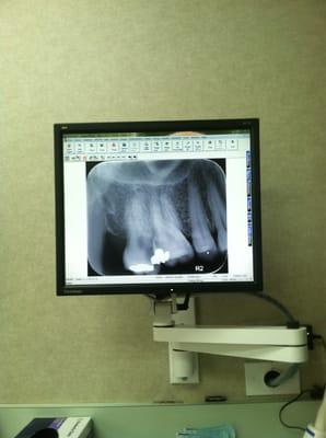 X-ray image right in the screen!