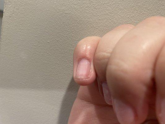 Example of cuticle shredded