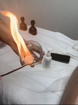 fire cupping