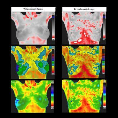 Wellness Thermography