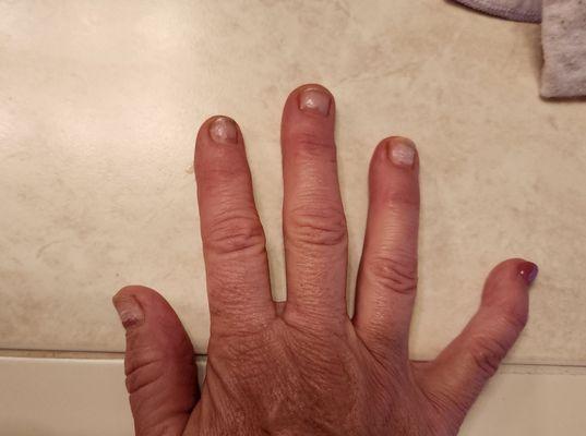 8 days after $40.00 dip manicure