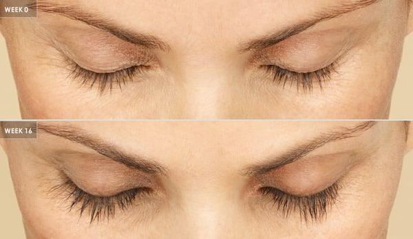 Grow longer, thicker eyelashes with Latisse, available from Dr. Comeau.