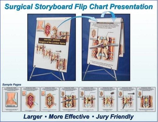 Surgical Storyboard Flip Chart Presentation