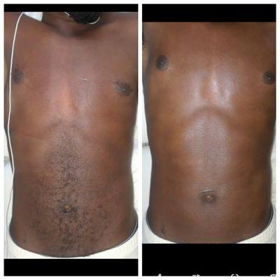 Men's Chest Wax
Before &  After