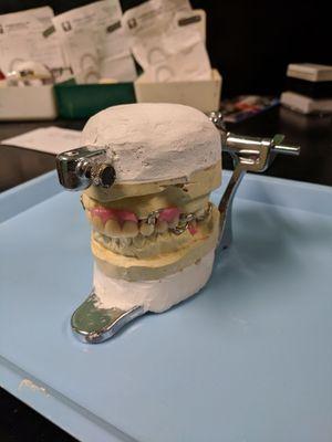 Dentures in the lab