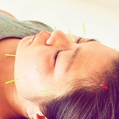 Facial acupuncture