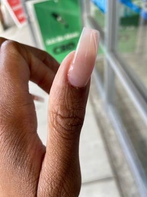 Many of my cuticles look like this