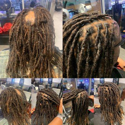 Balding??? I got you Loc Reconstruction $$250