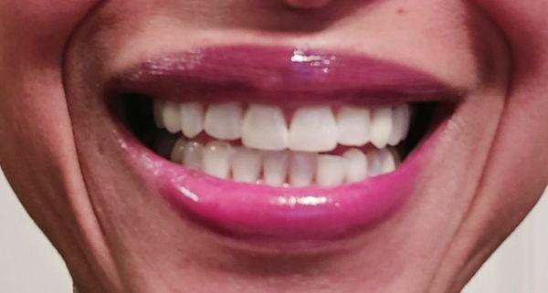 Love my white teeth!!