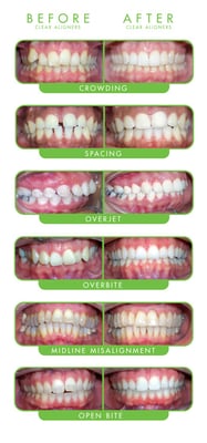 Ready to smile with confidence? Come in and see us for a free consultation!