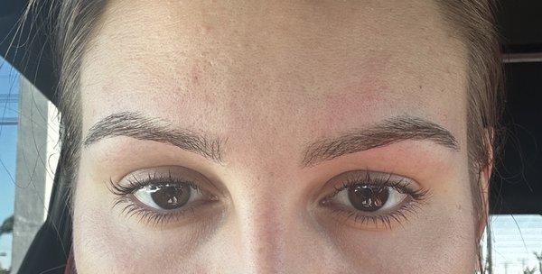 Uneven eyebrows