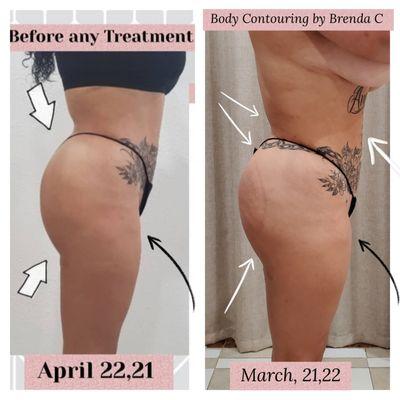 Body Contouring By Brenda C