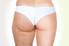 Troubled by cellulite?  You don't have to live with it!  Reduce the appearance in 16 weeks with Endermology, a clinically proven technique!