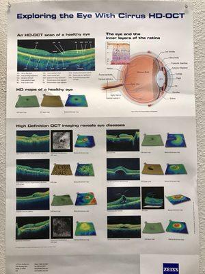 They can treat eye diseases like glaucoma and macular degeneration.