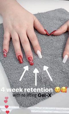 Retention