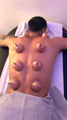 Cupping boosts circulation, eases muscle tension, and promotes healing, offering a swift escape from pain and stress.