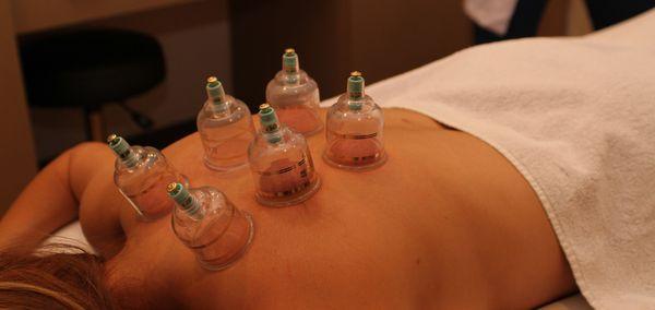 cupping