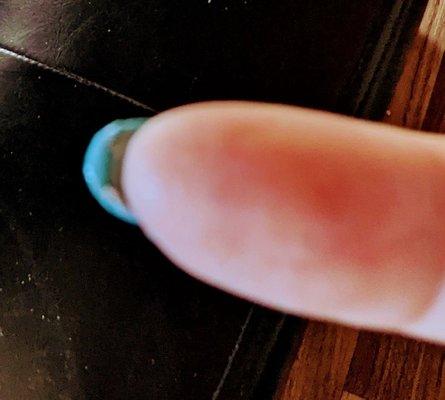 Undersides of nails have clumps of acrylic