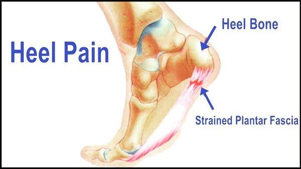 Regenerative injections like PRP or Amniotic Allograft help to: - Reduce pain naturally. - Improve joint function.