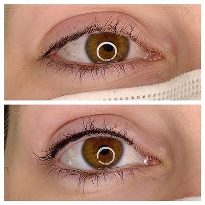 Lash Enhancement (Top)