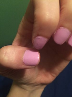 Bumpy polish, cuticles trimmed inconsistently, and paint on the skin.