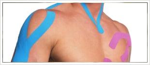 Kinesio Taping