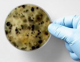 Mold - a deadly killer associated to water problems