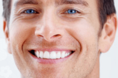 Dental Implants, Northwest Houston, Houston, TX