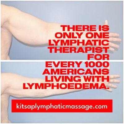 Kitsap Lymphatic Massage welcomes patients with lymphedema.